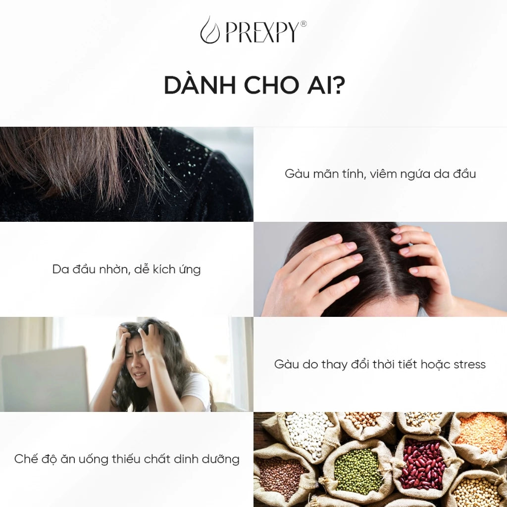 Serum Sạch Gàu Prexpy