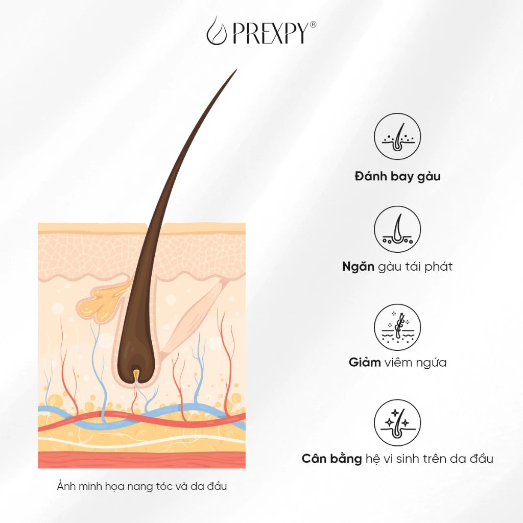Serum Sạch Gàu Prexpy